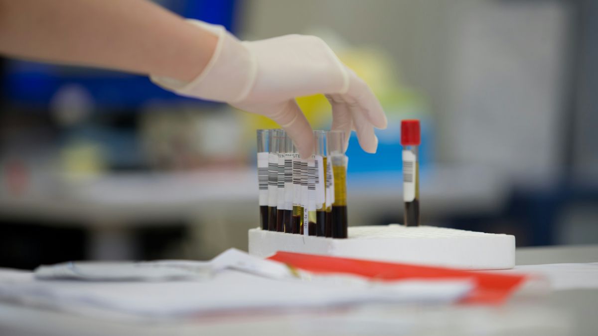 Пробирки с биоматериалом